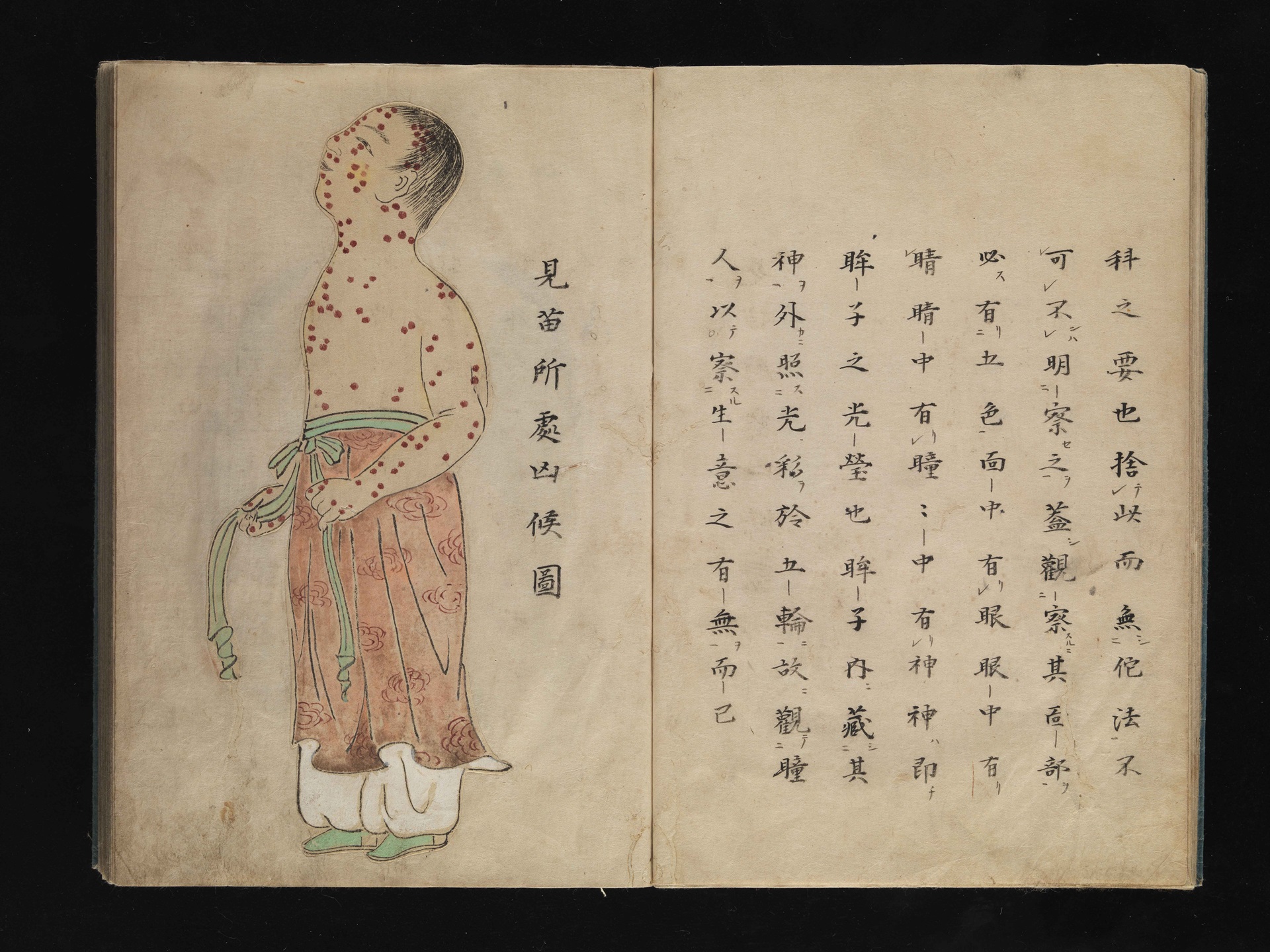 Ancient Japanese illustration of smallpox